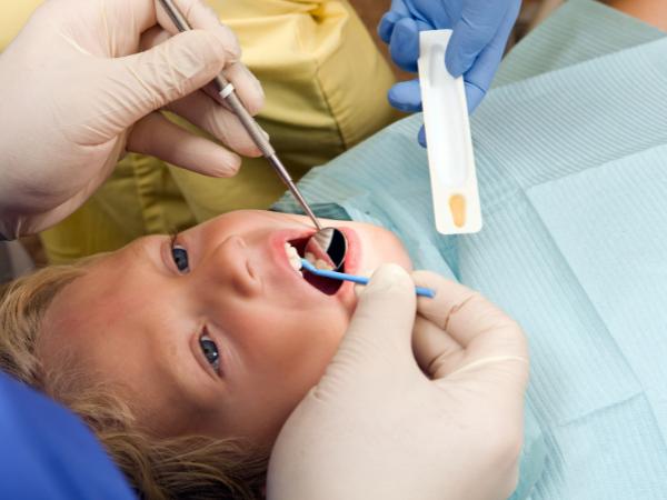 fluoride treatment for children