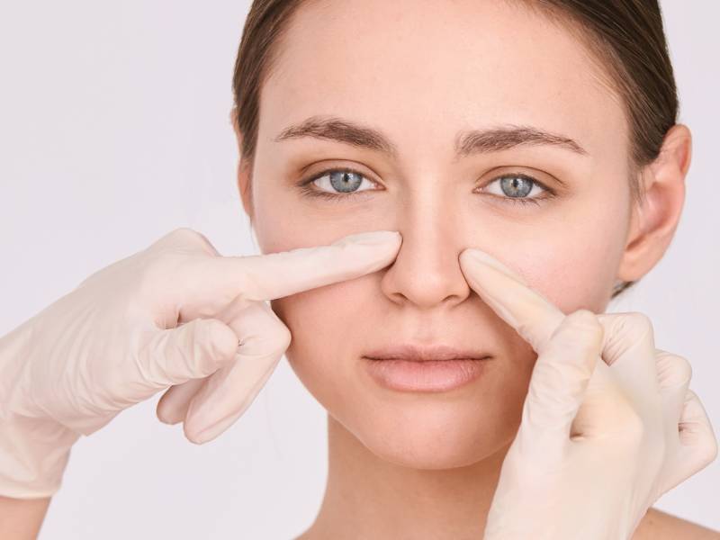 rhinoplasty nose job